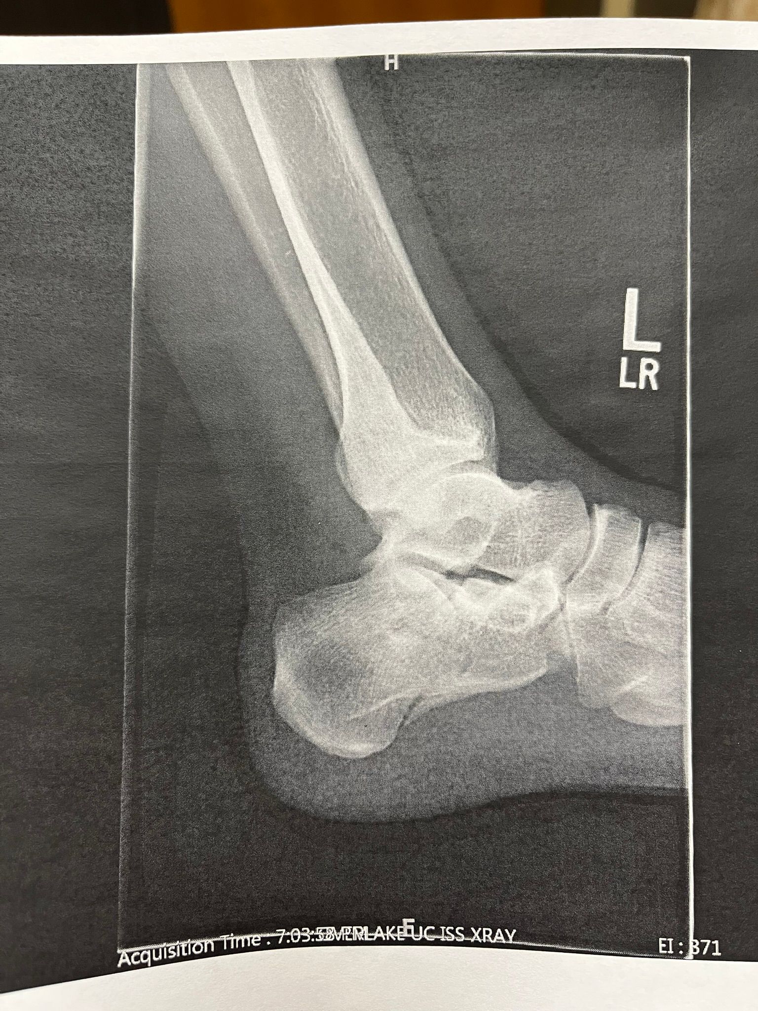 xray