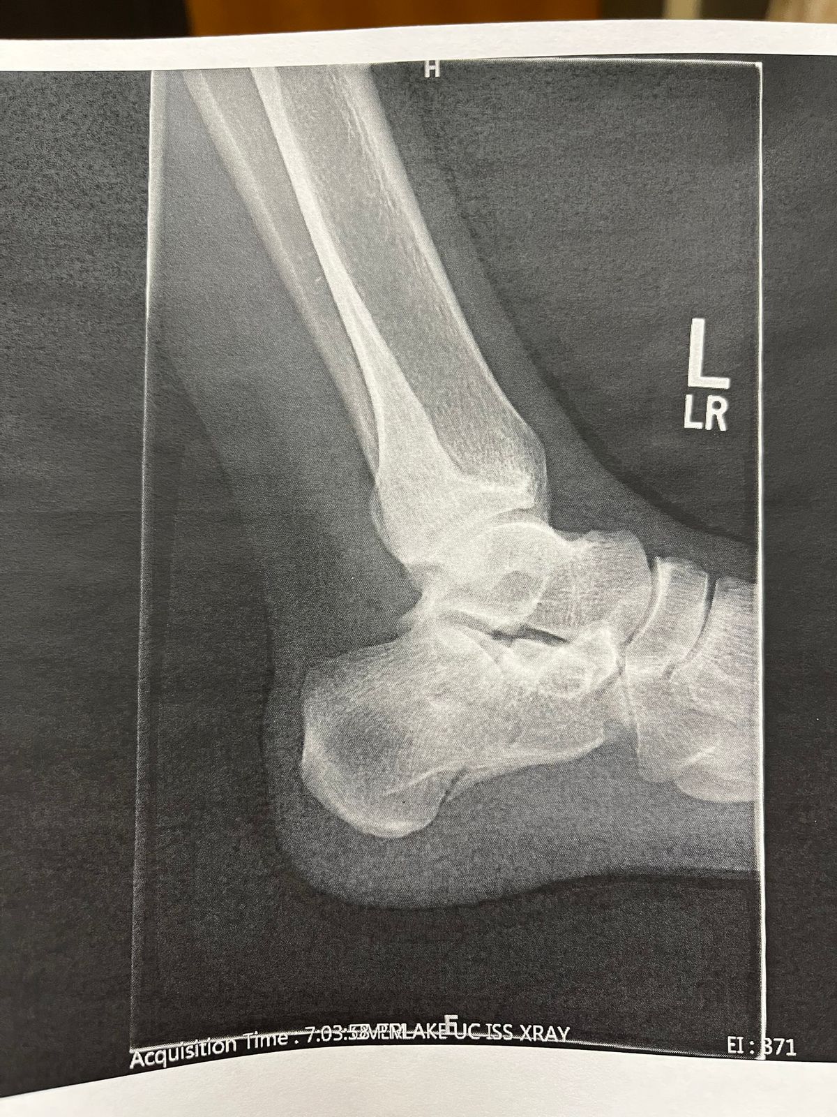 xray
